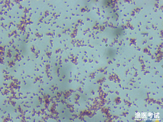 鲁氏耶尔森氏菌的革兰氏染色结果