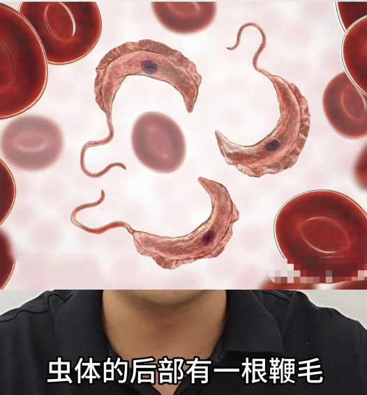 锥体虫