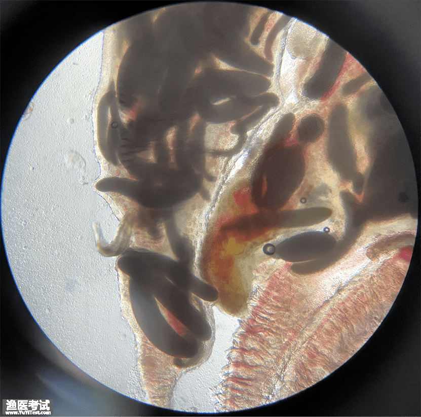 镜检鳃丝大量肤孢虫