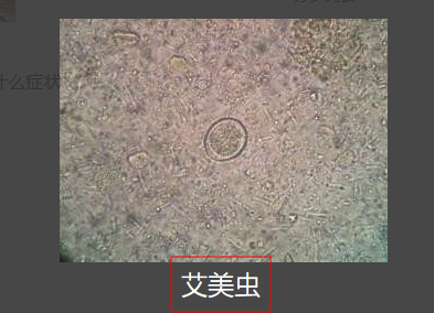 艾美虫